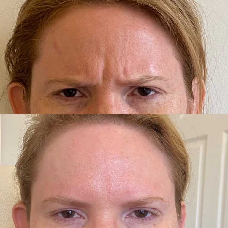 Before and After image