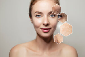 Age-Defying Skin Tightening | Eternal Beauty Skin Care Clinic