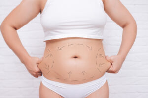 Body Contouring | Eternal Beauty Skin Care Clinic