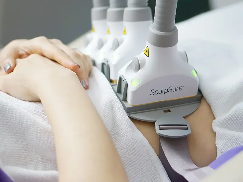 Sculpsure Treatment